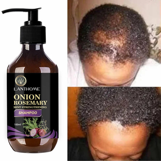 Hair Shampoo For Fast Hair Growth